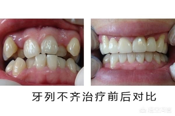 昌吉最新24小时牙医在线咨询方法分析(最方便真实的昌吉有没有24小时牙医方法)