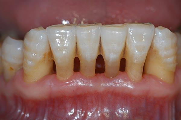 昌吉最新24小时牙医在线咨询方法分析(最方便真实的昌吉有没有24小时牙医方法)